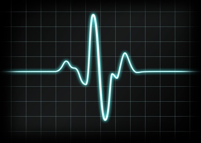 Electro-cardiogramme Electro-cardiogramme